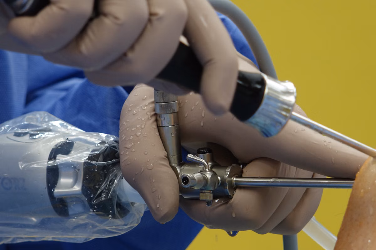 Partial Knee Replacement