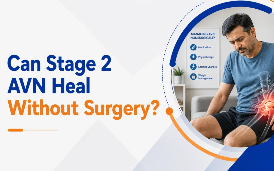 Can Stage 2 AVN Heal Without Surgery?