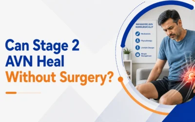 Can Stage 2 AVN Heal Without Surgery?