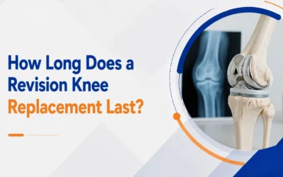 How Long Does a Revision Knee Replacement Last?