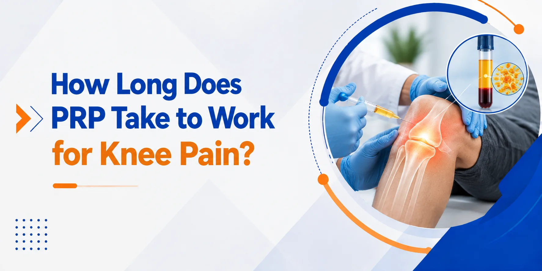 How Long Does PRP Take to Work for Knee Pain?