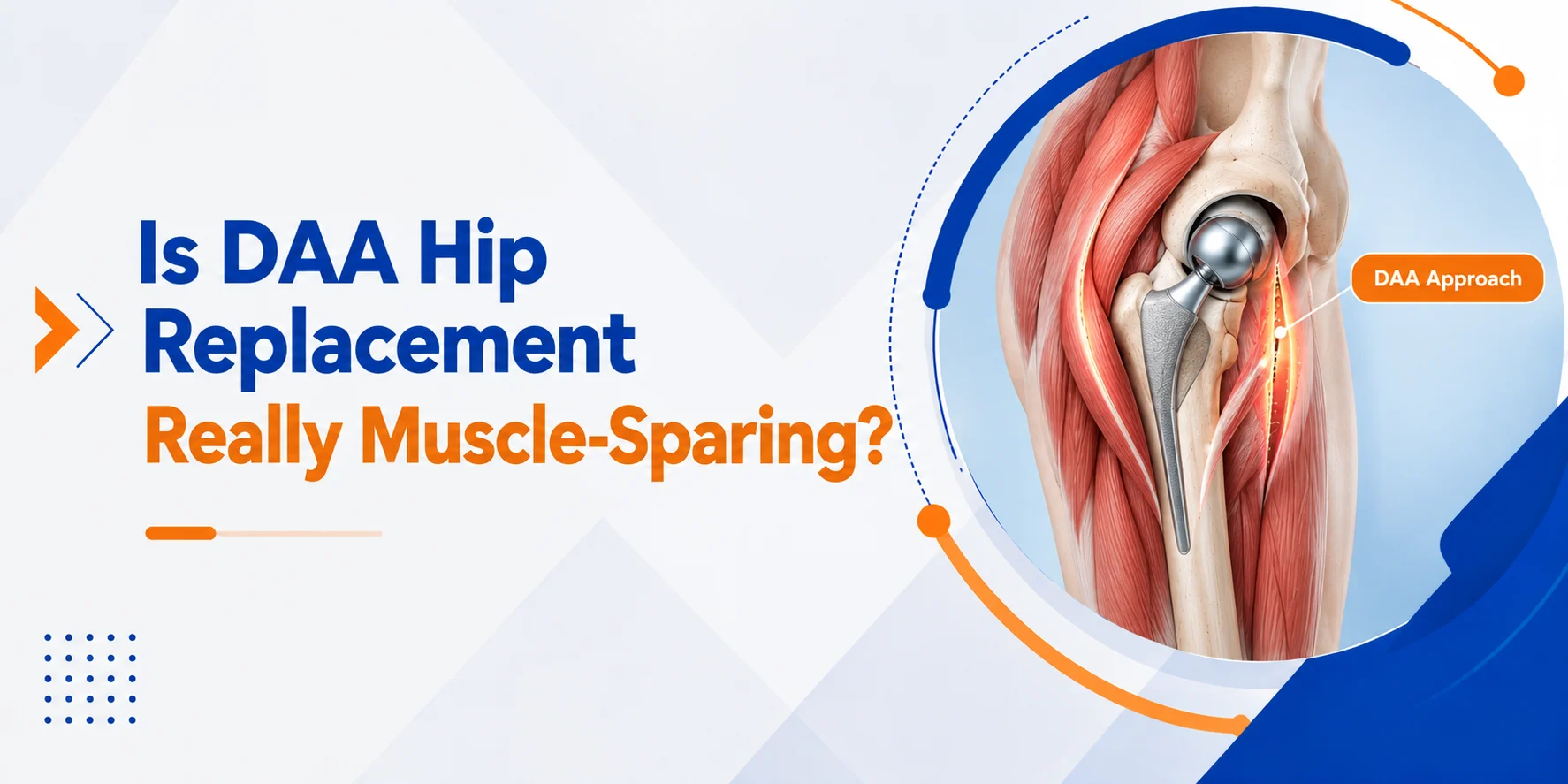 Is DAA Hip Replacement Really Muscle-Sparing?