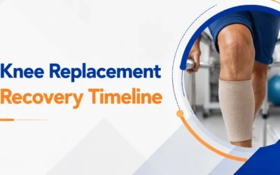 Knee Replacement Recovery Timeline: What to Expect Week by Week