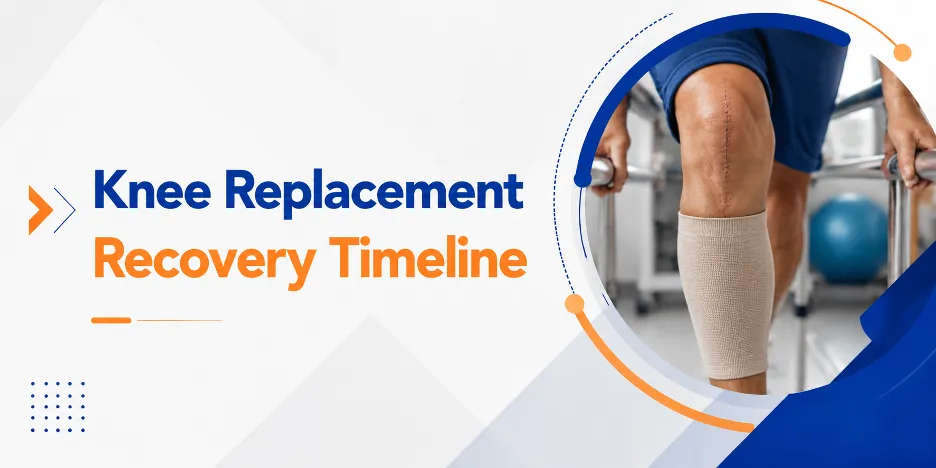 Knee Replacement Recovery Timeline: What to Expect Week by Week